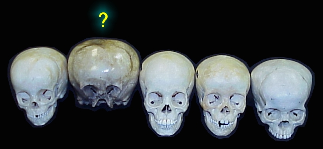 Comparing Skulls