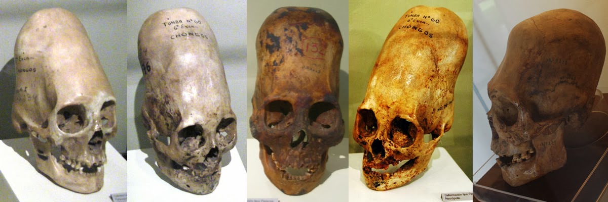 Five Paracas Elongated Skulls