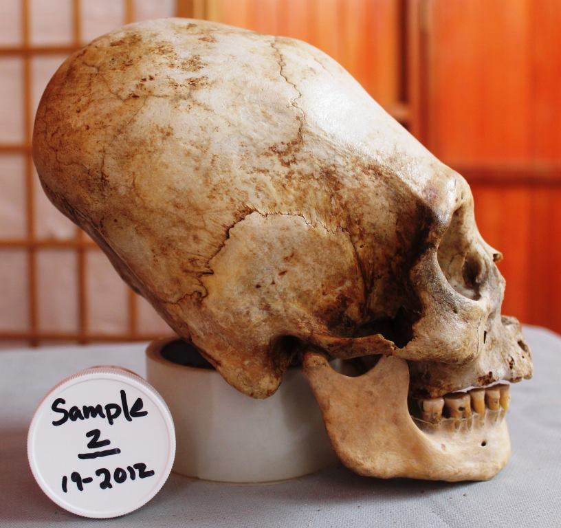 Paracas Skull Used for DNA Sample 2